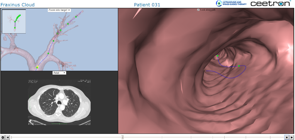 The diffusion of 3D visualization technologies from the field of CAE to the medical field
